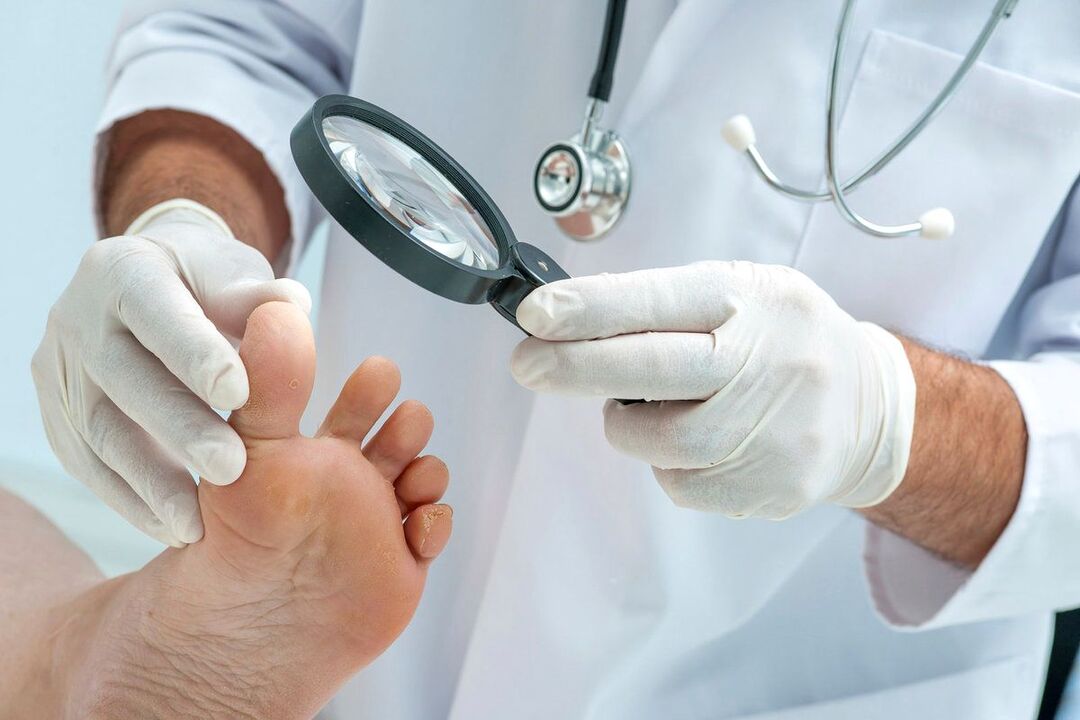 lékař zkoumá nohy s houbou