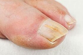 Pozemek -Finger