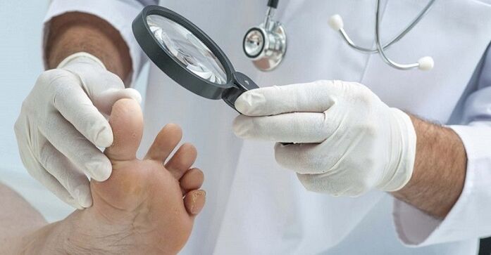 lékař zkoumá chodidla na nehty