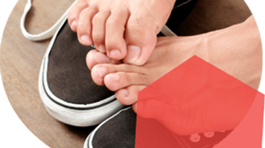 svědění kůže na nohou, příznaky infekce plísní